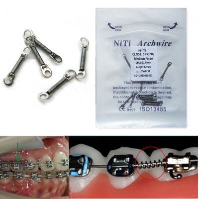 10 PCs / paquet Ressorts pour l'orthodontie dentaire Bobine fermée Niti fil d'ar...