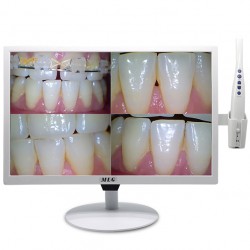 MLG M-978A Caméra intra-orale sans fil 5G WIFI avec moniteur LCD 19 pouces