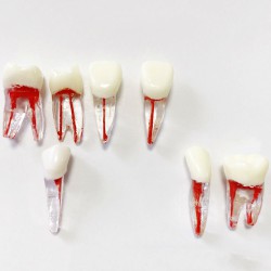 Modèle de dents dentaires pour pratique des limes endo (molaire/dent supérieure ...