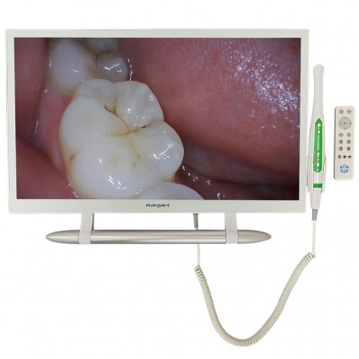 Caméra intra-orale dentaire Magenta YF-2200M avec Wifi et moniteur 21,5 pouces