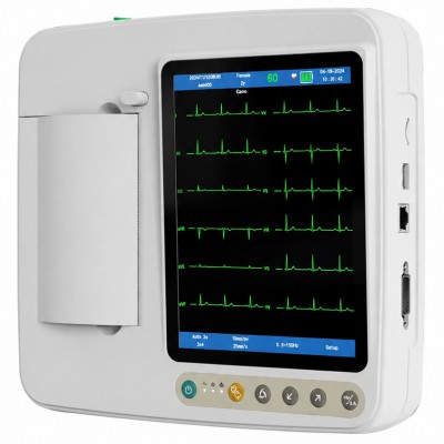 Électrocardiographe SINNOR ECG906 à 12 dérivations, affichage 6 canaux