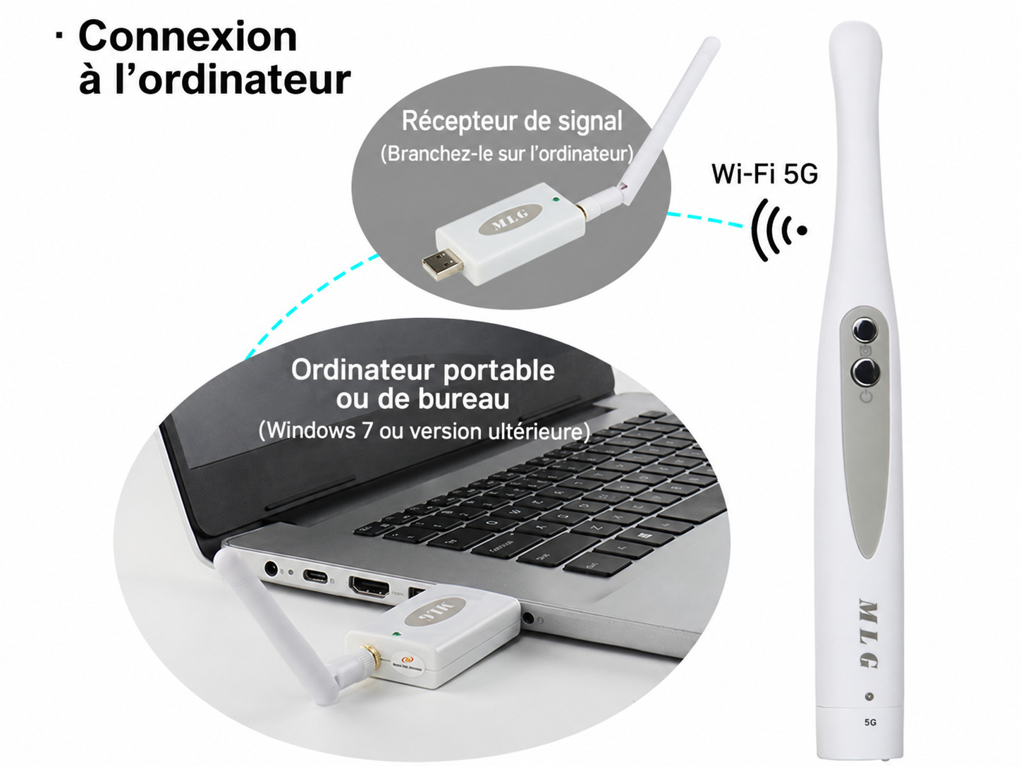 Cam&eacute;ra intra-orale dentaire sans fil MLG CF680, 1080p, avec 8 lumi&egrave;res LED