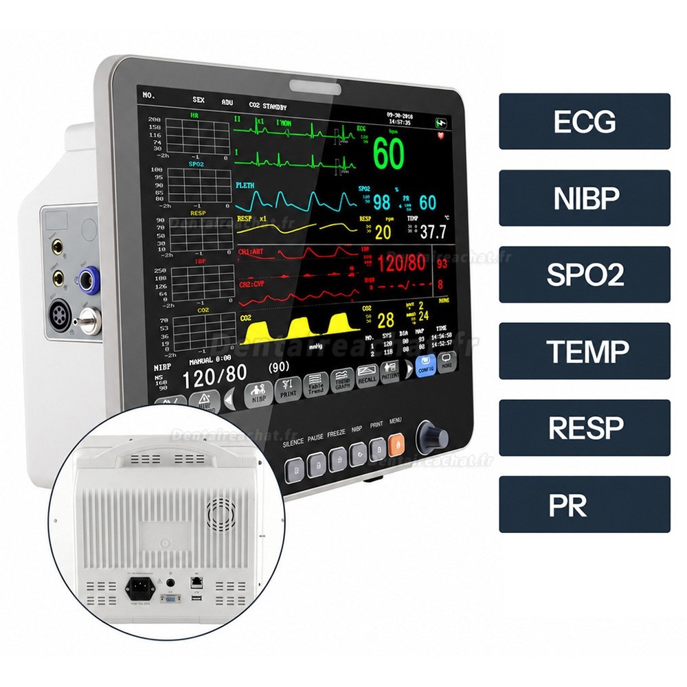 Moniteur patient multiparam&eacute;trique 15,6 pouces ECG, PNI, RESP, TEMP, SpO2, FC