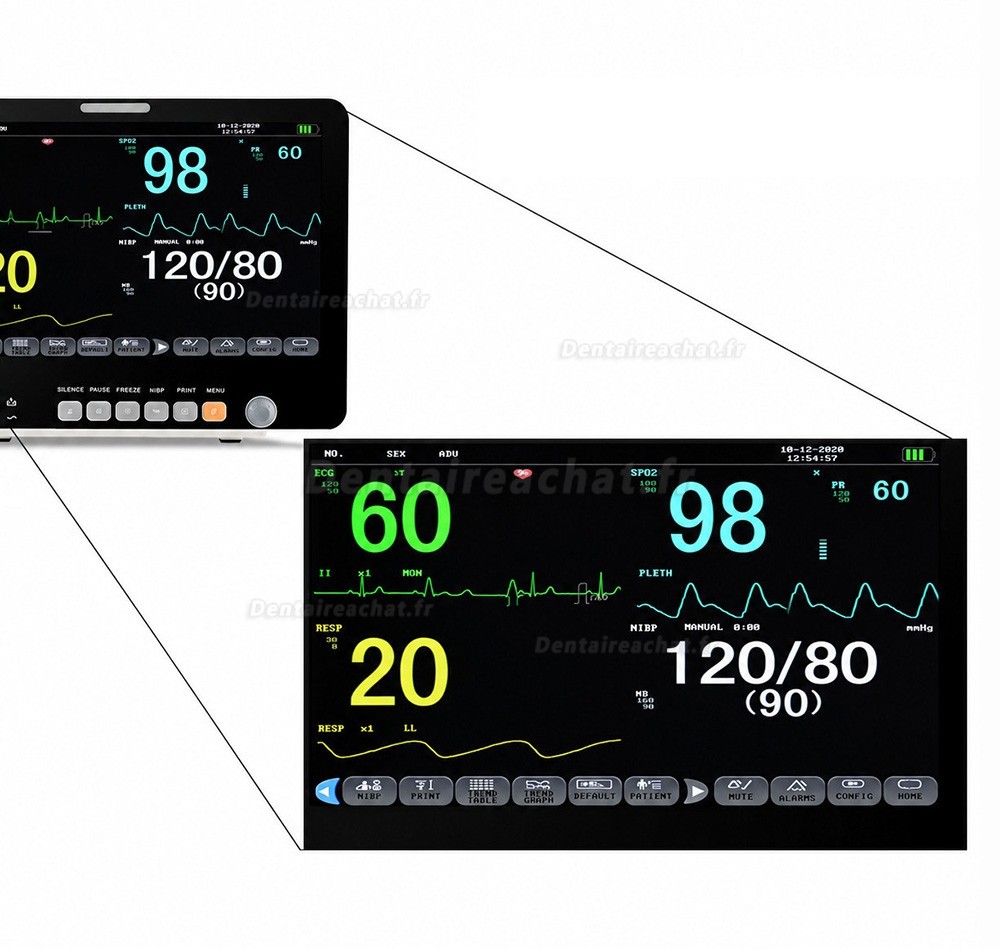 Moniteur patient multiparam&eacute;trique 15,6 pouces ECG, PNI, RESP, TEMP, SpO2, FC