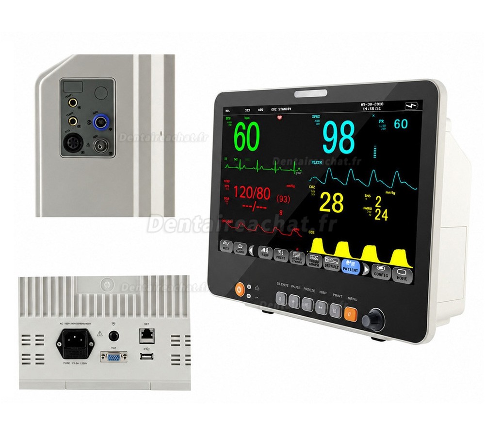 Moniteur patient multiparam&eacute;trique 15,6 pouces ECG, PNI, RESP, TEMP, SpO2, FC