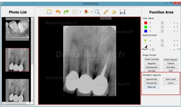 Appareil radiographie portable dentaires AD-60P + Capteur radio dentaire Handy HDR 500