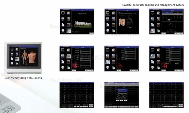 CONTEC® ECG-1200G Moniteur électrocardiographe numérique 12 canaux