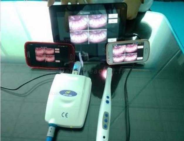 MLG® M-888 WIFI Caméra intra-orale dentaire sans fil
