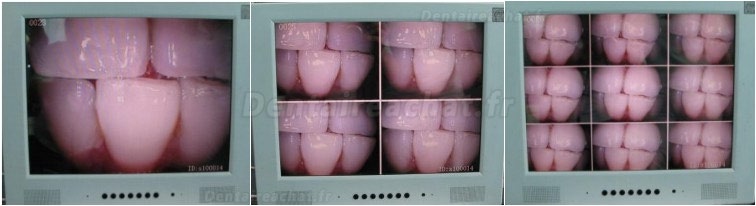 MLG® M-888 WIFI Caméra intra-orale dentaire sans fil