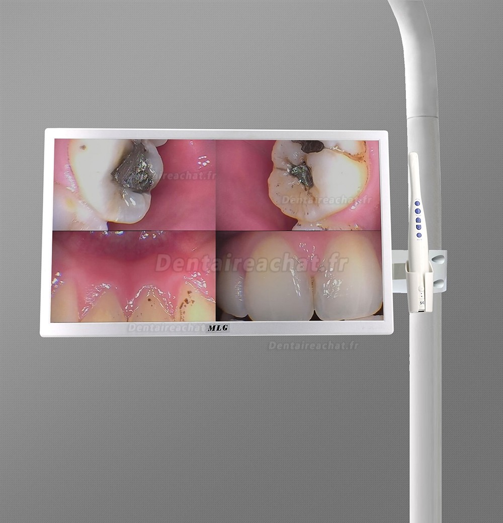MLG M-978A Caméra intra-orale sans fil 5G WIFI avec moniteur LCD 19 pouces