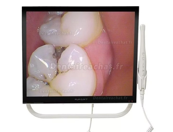 Caméra intra-orale dentaire Magenta YFHD-D 1/4 Sony CCD avec moniteur 17 pouces