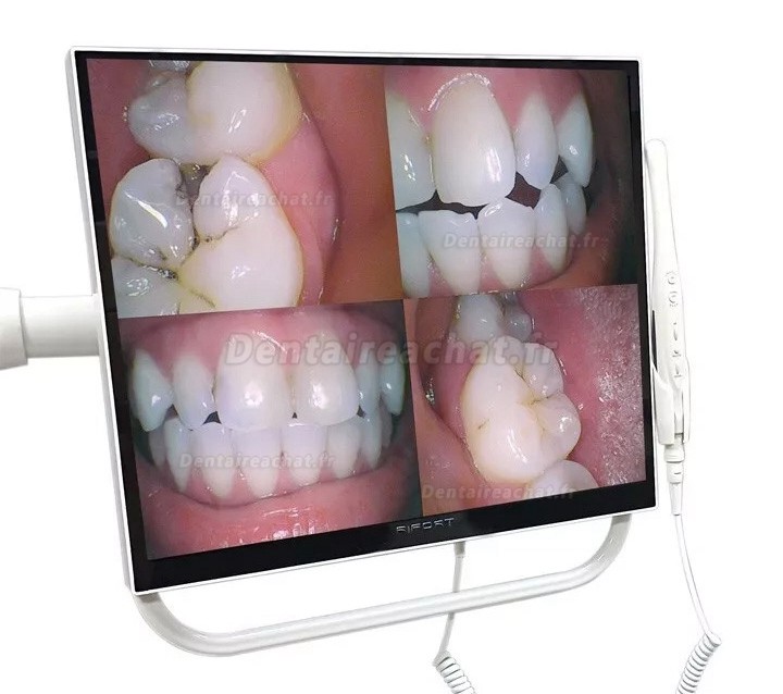 Caméra intra-orale dentaire Magenta YFHD-D 1/4 Sony CCD avec moniteur 17 pouces