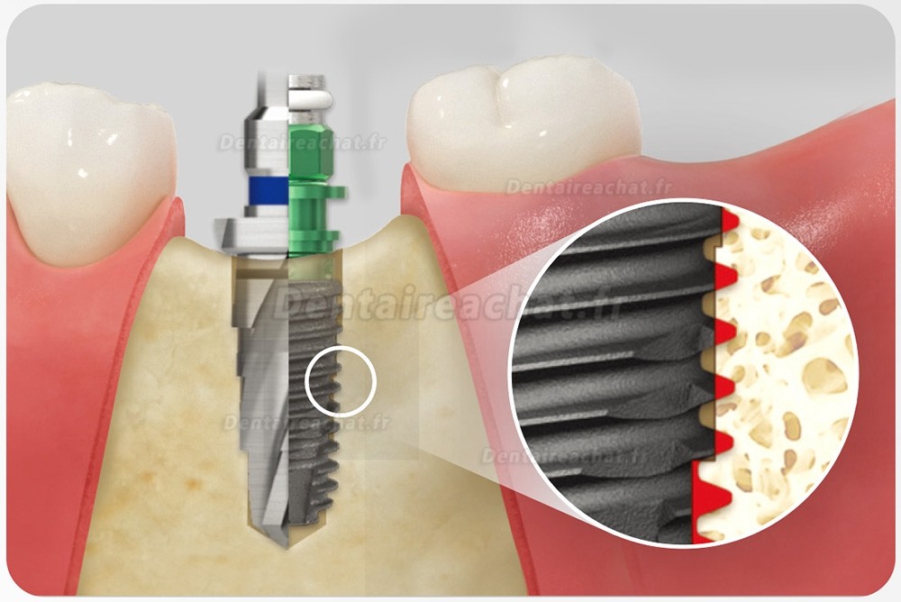 Kit chirurgical Taper Osstem Hiossen avec clé dynamométrique (à utiliser pour TSⅢ/Ⅳ SSⅢ USⅢ/Ⅳ)