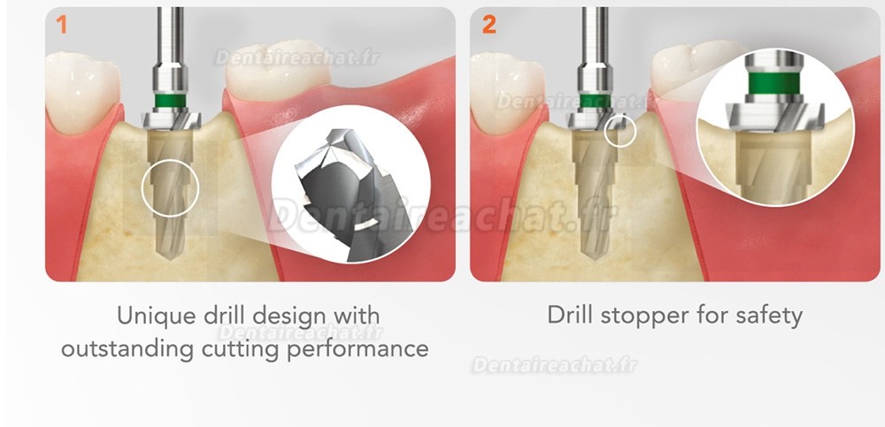 Kit chirurgical Taper Osstem Hiossen avec clé dynamométrique (à utiliser pour TSⅢ/Ⅳ SSⅢ USⅢ/Ⅳ)