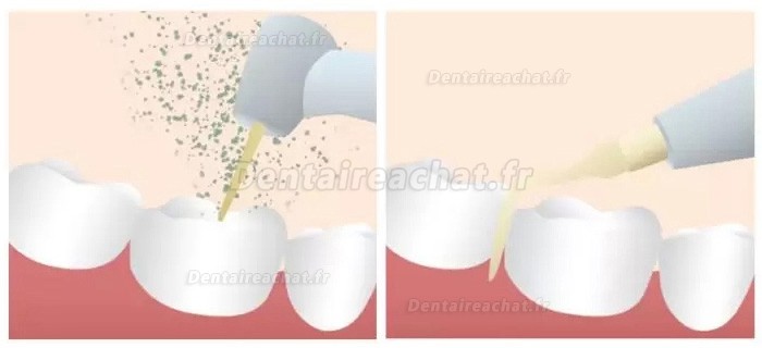 Refine MaxSurgery Piezo Appareil de piézochirurgie dentaire système de chirurgie osseuse piézoélectrique à ultrasons