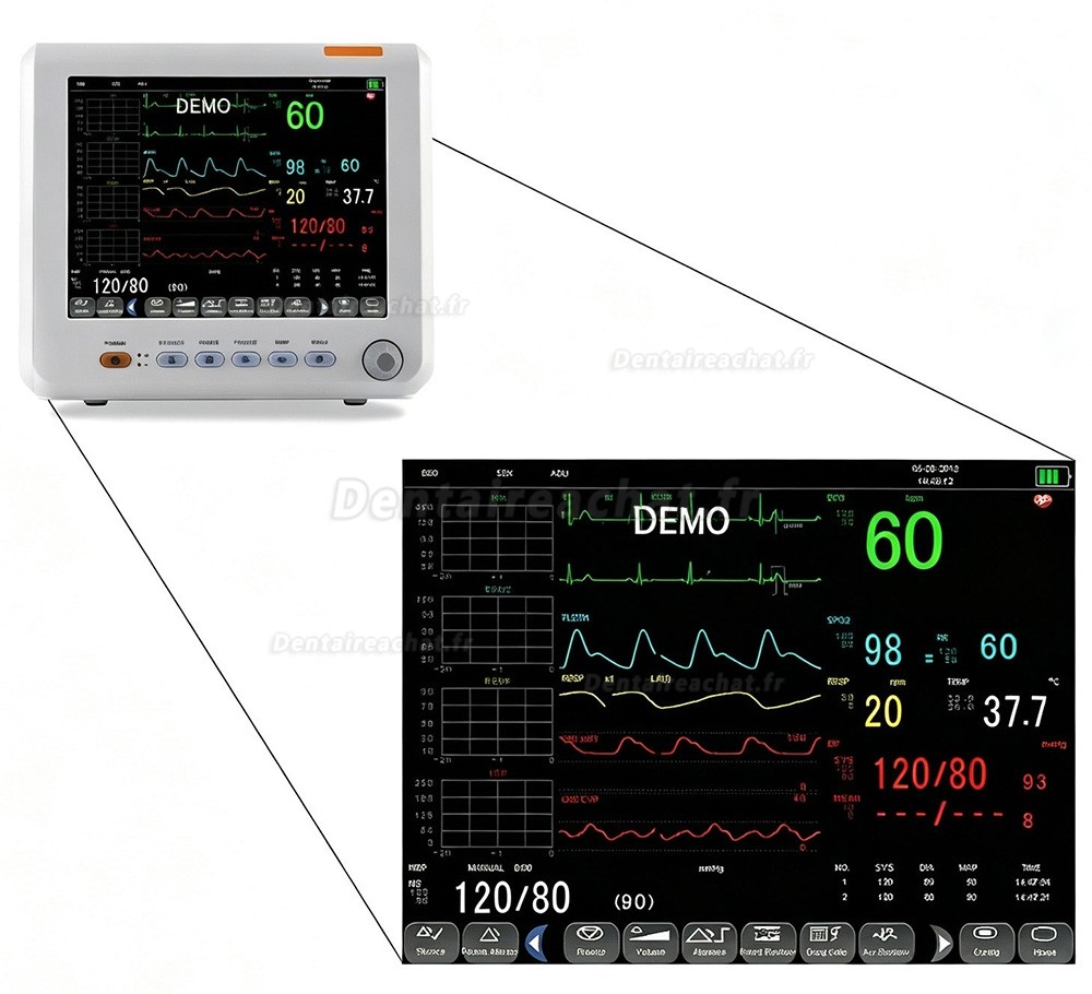 Moniteur patient multiparamétrique SINNOR SNP9000L-D 8 pouces, 6 paramètres (ECG, PNI, RESP, TEMP, SpO2, FC) Moniteur patient multiparamétrique SINNOR SNP9000L-D 8 pouces, 6 paramètres (ECG, PNI, RESP, TEMP, SpO2, FC)