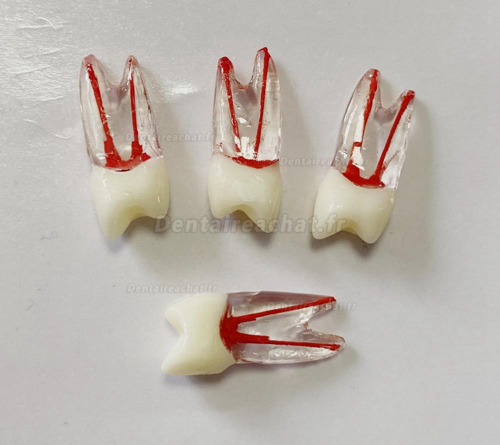 Modèle de dents dentaires pour pratique des limes endo (molaire/dent supérieure inférieure/prémolaire)