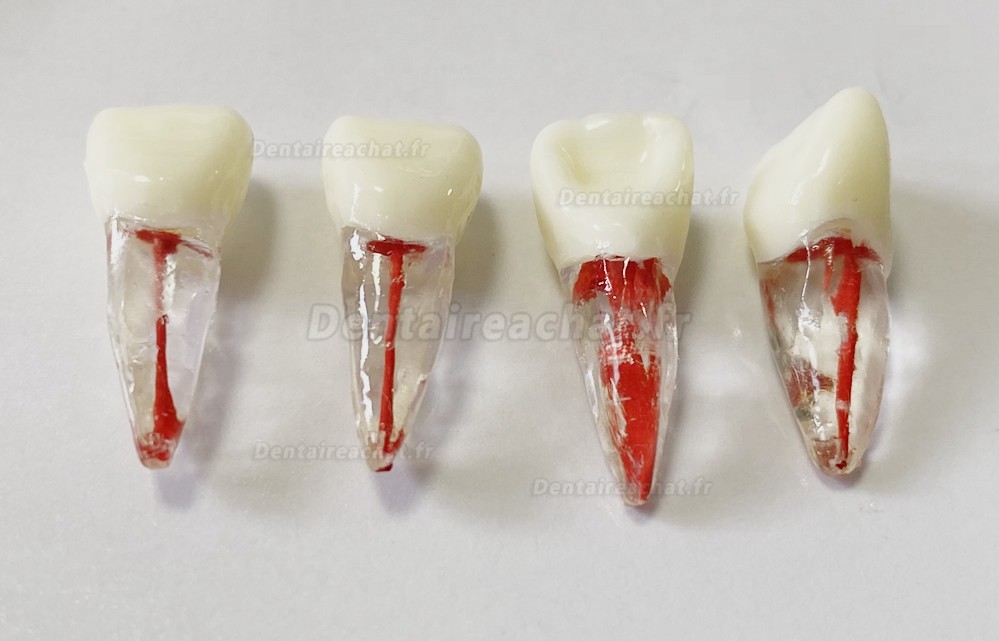 Modèle de dents dentaires pour pratique des limes endo (molaire/dent supérieure inférieure/prémolaire)