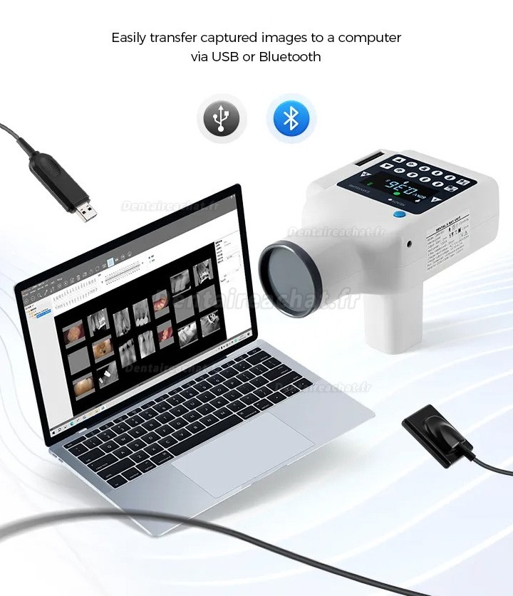 Appareil de radiographie dentaire portable avec écran intégré et capteur de rayons X numérique