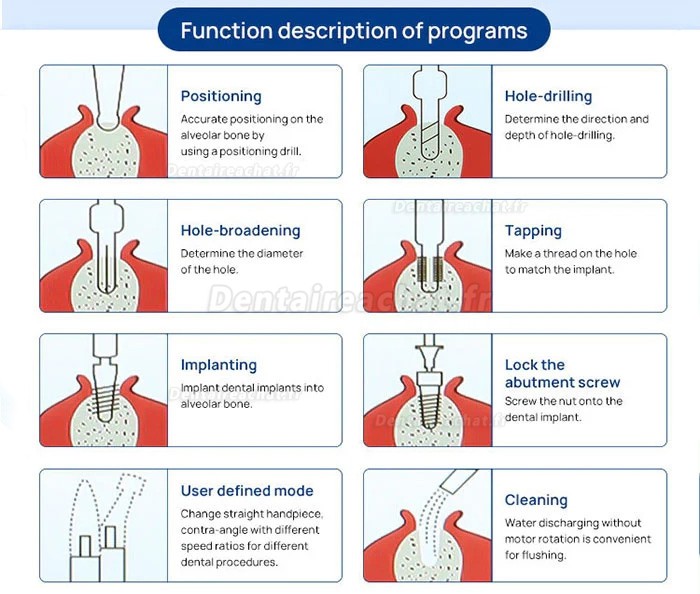 Moteur implantologie dentaire et Unité d'implants dentaires Yahope IMPLANT surg