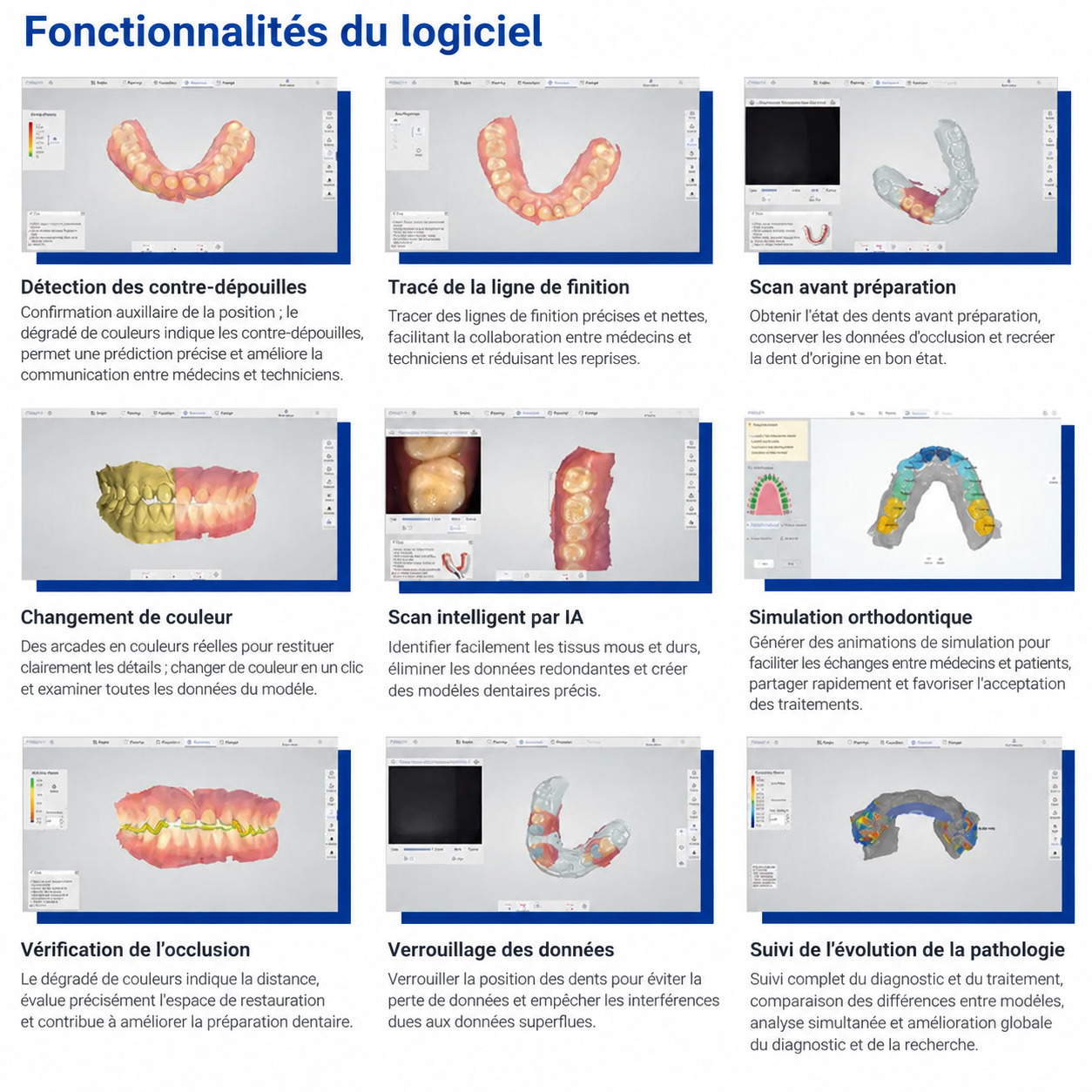 Scanner intra-oral 3D sans fil Panda P4 (fourni avec 6 embouts de num&eacute;risation)